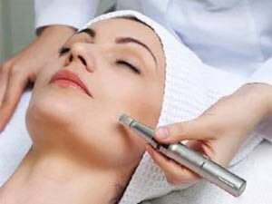 MICRONEEDLING